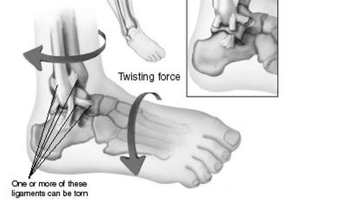 تعرف على اصابة الكاحل وكيفية التعافي منها ؟ 